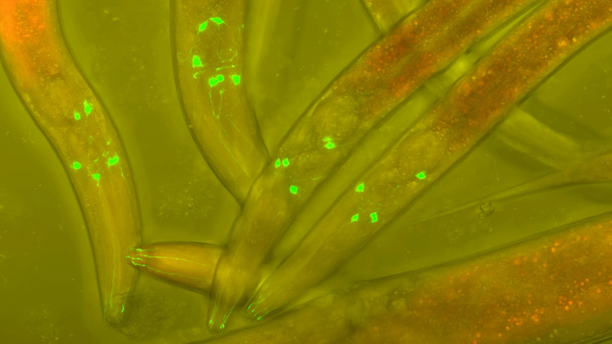 Caenorhabditis elegans